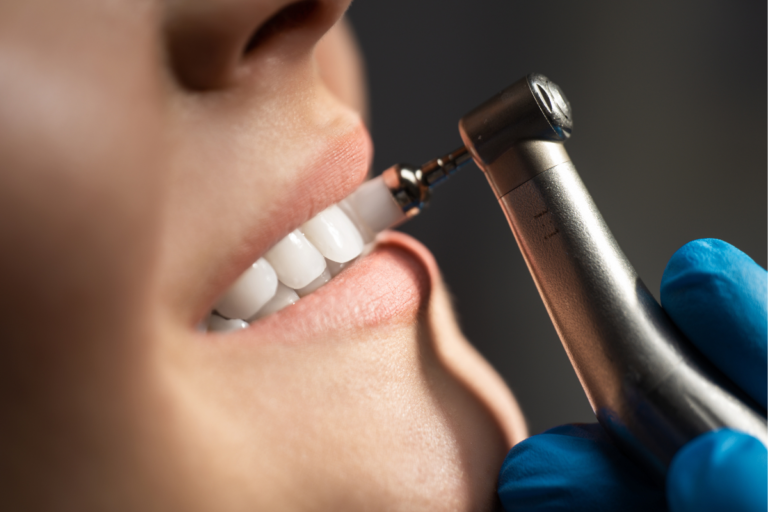 6 Common Myths About Common Dental Procedures