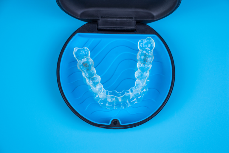 Questions About Clear Aligners
