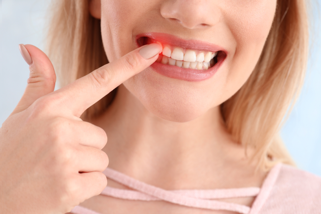 Gum disease treatment naples dental boutique 1