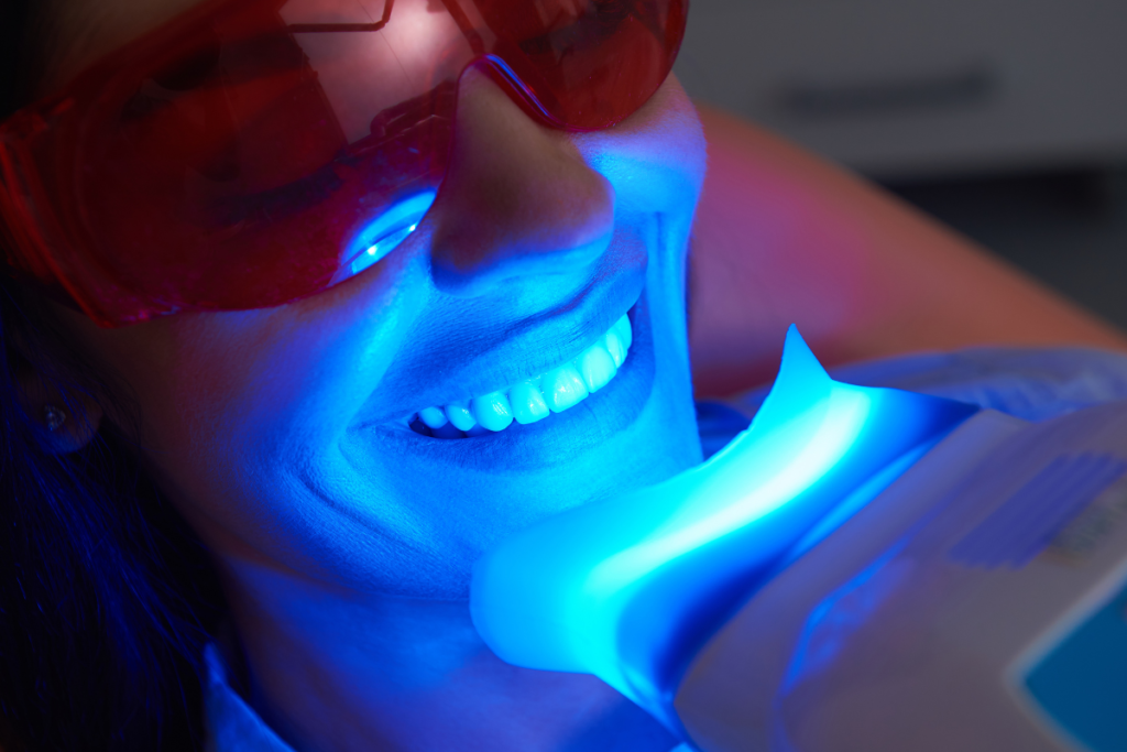 Teeth whitening naples dental boutique 2