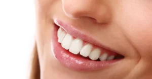 Close-up of a woman’s smile showing clean, naturally white teeth, highlighting the results of professional teeth whitening suitable for sensitive teeth.