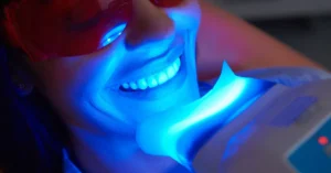 Close-up of a woman undergoing professional teeth whitening with a blue led light, wearing protective red glasses during an in-office cosmetic dentistry procedure.