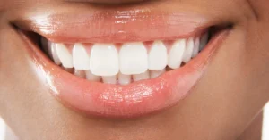 Close-up of a smiling person with bright, well-aligned teeth, showcasing the natural appearance and aesthetic results of dental treatments like same-day crowns.