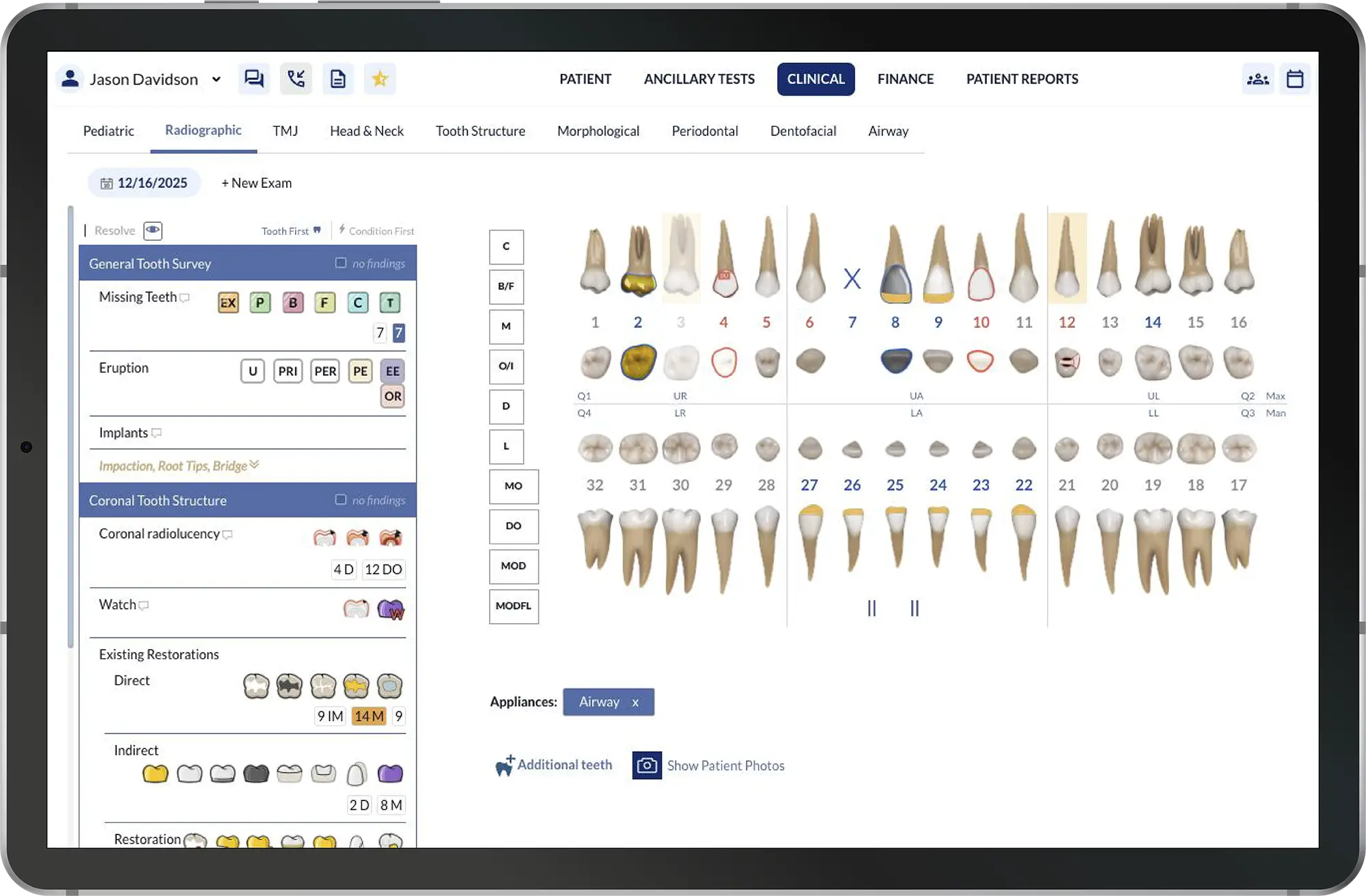 Dental examination and treatment planning interface used an ai in dental practice